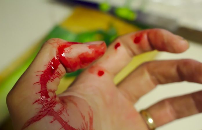 Blutende Hand