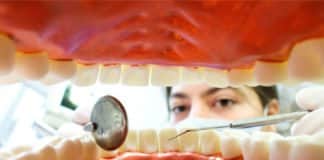 Zahnarzt nur noch für Besserverdiener? Schweitzer schießt gegen CDU-Pläne