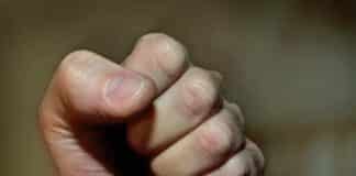 RLP: Autofahrer schlägt Fußgänger unvermittelt ins Gesicht — mit Hinterkopf auf Asphalt aufgeschlagen