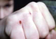 RLP: Männer prügeln sich auf der Straße — Vier Verletzte, u.a. Schnittwunden