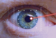 Augenlasern im Vergleich: Diese Optionen gibt es in Deutschland und der Schweiz