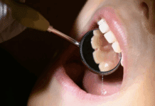 Alarmierende Zahlen: Kinder in Rheinland-Pfalz meiden den Zahnarzt – und Eltern auch!