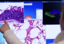 Sterbefälle im Saarland: Das sind die häufigsten Todesursachen